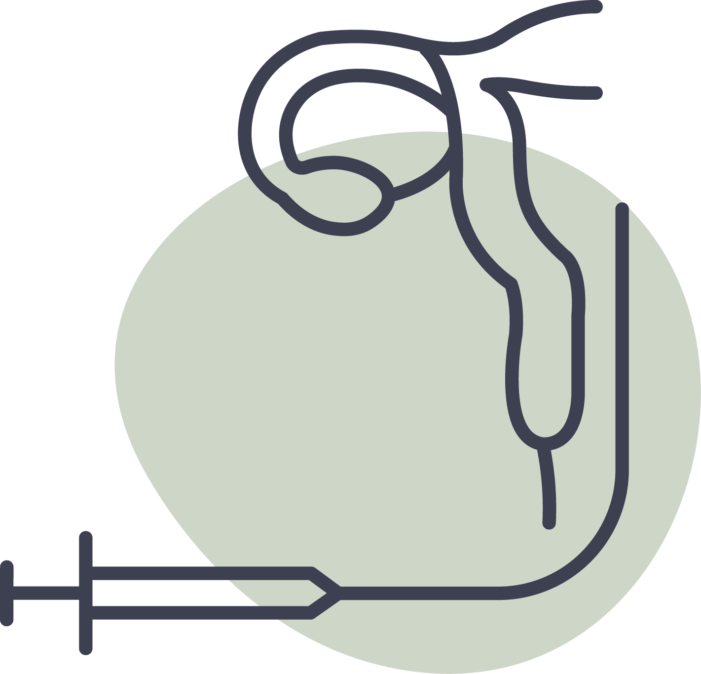 fryklunds-grafik_tubarspolning